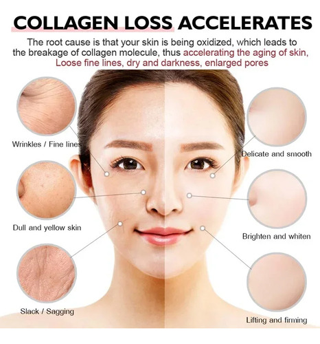 Crema Facial De Colágeno De Caracol, Blanqueadora, Hidratant