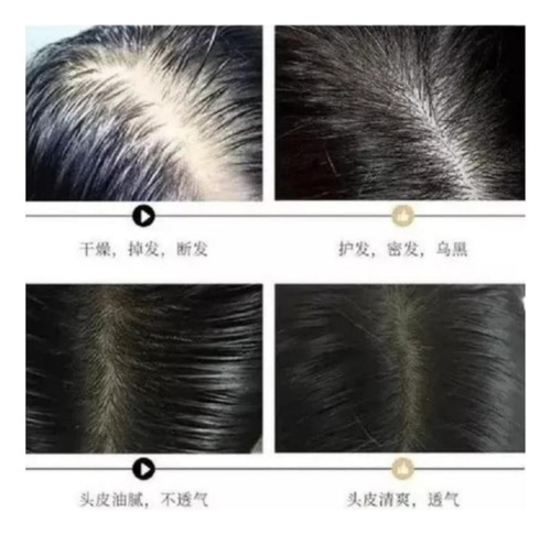 3 Shampoo Reparador Raíz Jengibre Anticaída Crecimiento