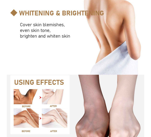 Crema Aclaradora N Skin Whitening Cream Para Íntimos A 1005