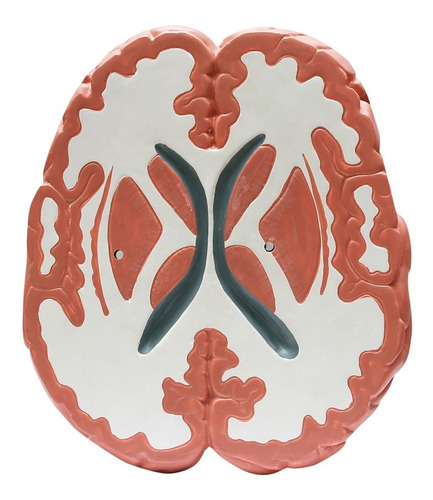 Modelo De Anatomia Do Cérebro Com Corte Transversal