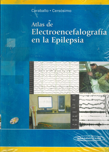 Atlas De Electroencefalografía En La Epilepsia - Caraball 