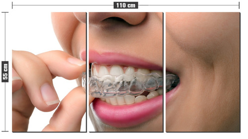 Kit Quadro Decorativo Clareamento Dentista Odonto Consultóri
