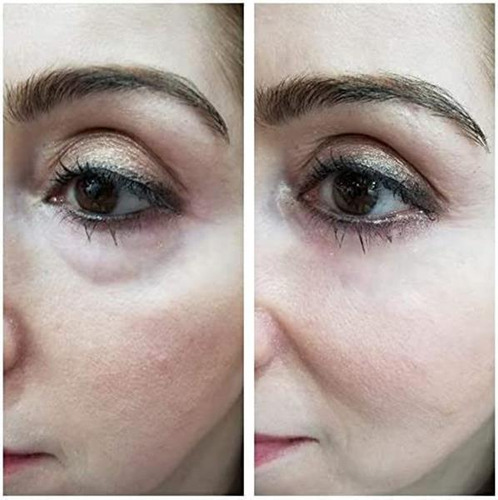 Vitayes Instant Ageback, Ageless Facelift Cream For Instant