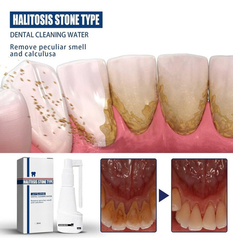 4×pasta Dientes For Quitar Manchas, Potente Y Sin Sarro