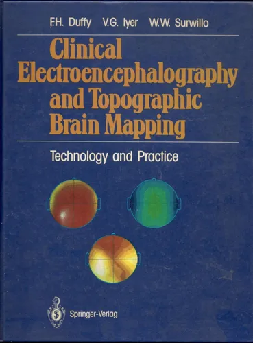 Clinical Electroencephalography