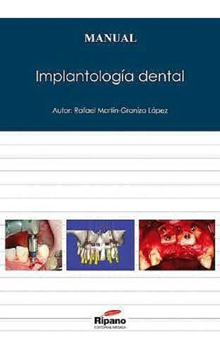 Implantologia Dental Ripano