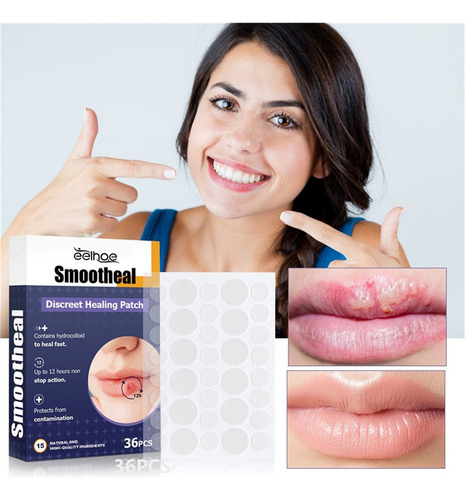 2×parches Suavizantes Para Herpes Labial Parche Curativo