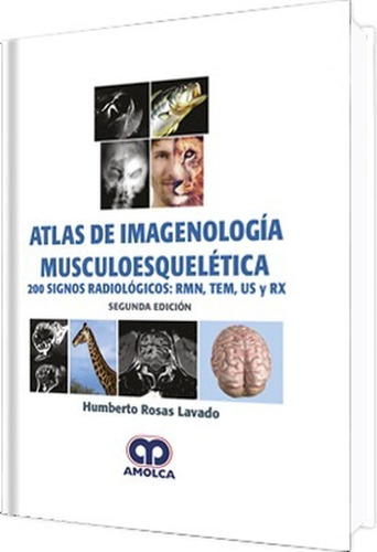 Atlas De Imagenología Musculoesquelética, De Humberto Rosas Lavado. Editorial Amolca En Español