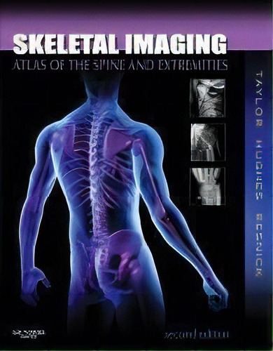 Skeletal Imaging : Atlas Of The Spine And Extremities, De John A.m. Taylor. Editorial Elsevier Health Sciences, Tapa Dura En Inglés