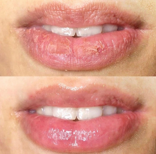 Laneige Lábios Máscara Lips Sleeping Mask Berry 3g The Best