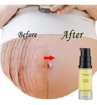 Comprar Peeling Estrias Estria No Seio Barriga Com Estrias Pós Parto