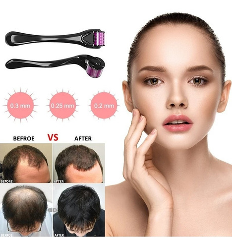 Dermaroller | Alopecia Manchas Cicatrices 0.20 0.25 0.30 Mm