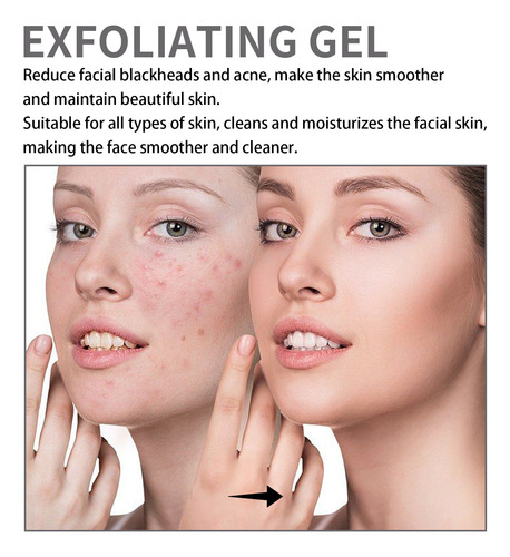 Creme De Clareamento Facial Para Fechar Os Poros Abertos, Es