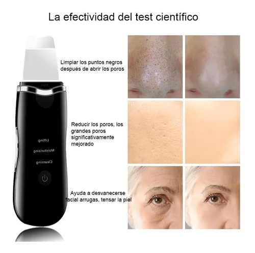 Espátula Ultrasónica Peeling Facial Limpieza Profunda Origin | Envío gratis