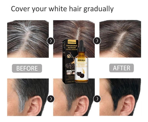 Suero Tratamiento De Las Canas, Color Natural Unisex