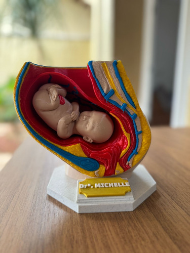 Modelo De Pelve Feminina Com Bebe - Gravidez - Anatômico