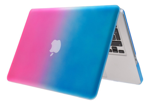 Carcasa Case Funda Protector Para Macbook Pro 15'' A1286