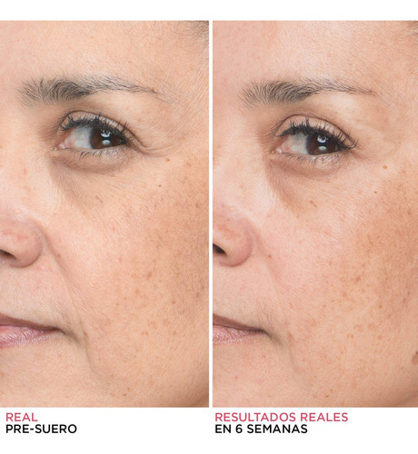 It Cosmetics Bye Bye Lines Suero Á. Hialurónico Vit. B5 30ml Todo Tipo De Piel Día/noche