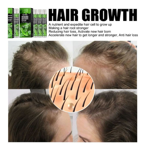 3 Herbal Hair Growth Spray Cabelo Essencial Óleo Perda De Ca