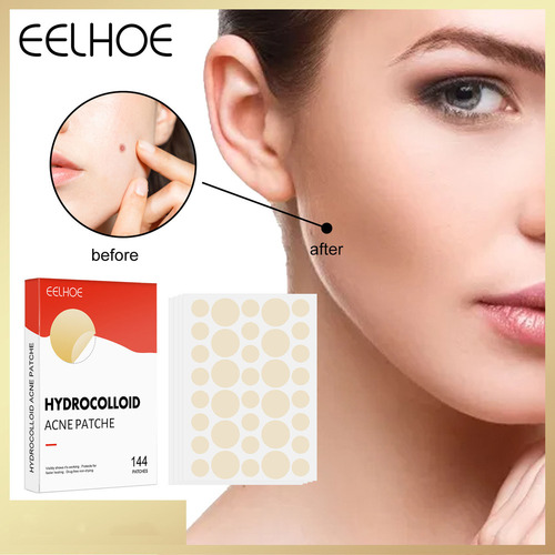 Parche Hidrocoloide For Espinillas Y Acné For Espinillas E