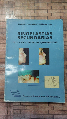 Rinoplastias Secundarias - Tacticas Y Tecnicas - Jorge Orlan