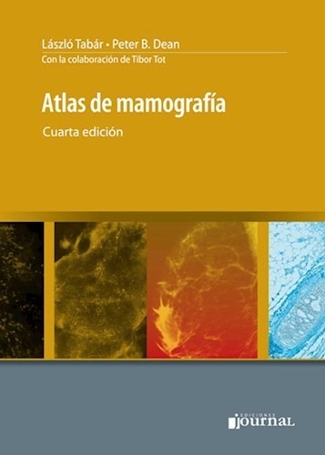Tabár - Atlas De Mamografía 4° Ed.
