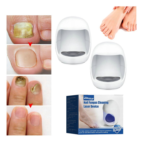 2×dispositivo Láser Limpieza Uñas Para Onicomicosis A