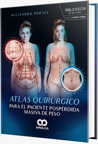 Atlas Quirúrgico Para El Paciente Pospérdida Masiva De Peso