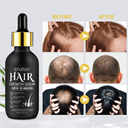 Sérum Para El Crecimiento Del Cabello Flasture Con 5% De Min