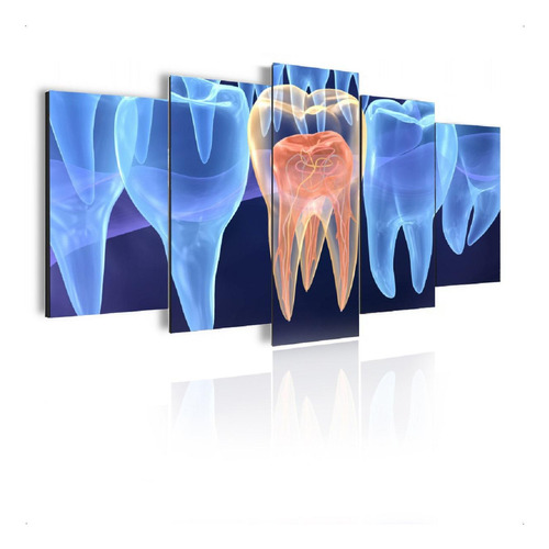 Quadro Decorativo Mosaico Odontologia Raiox Dentes Mod748