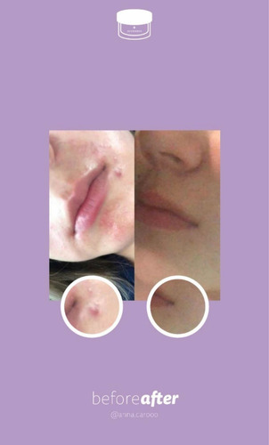 Imagen 7 de 9 de Crema Juveness Plus, Crema Para Mujer