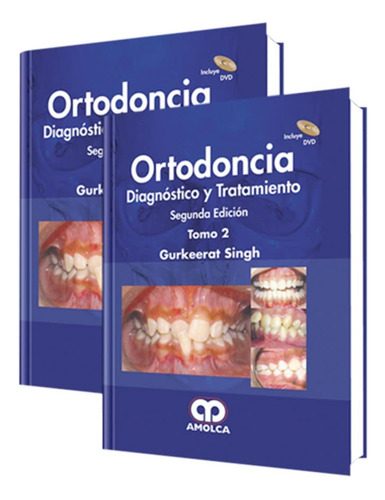 Ortodoncia Diagnóstico Y Tratamiento 2 Edición, Tomo 1 Y 2