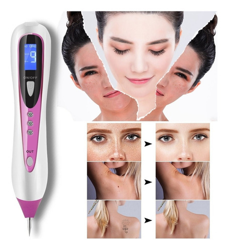 Láser Lcd Laser Etiqueta Peca Verruga Punto Topo Quitar Plum