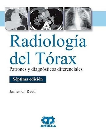 Radiología Del Tórax Ed.7 Patrones Y Diagnósticos Diferenci