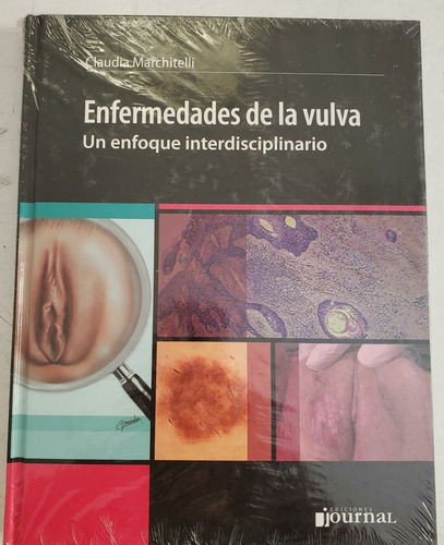 Enfermedades De La Vulva Un Enfoque Interdisciplinario