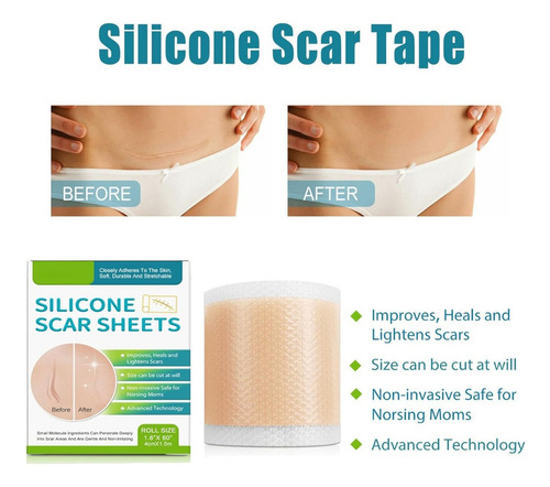. Láminas De Silicona Profesionales For Cicatrices