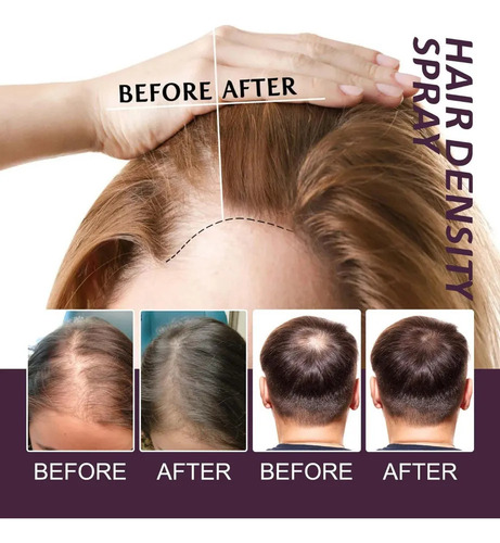 Spray Para Dar Volumen Al Cabello, Espray Para Aumentar El -