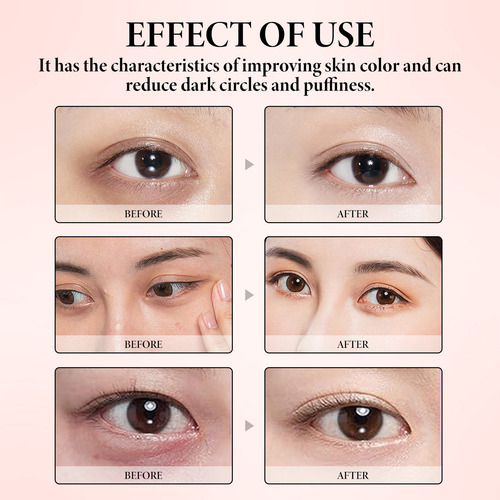 M Care Action Eye Cream Fine Lines And Dark Rings For G 1002
