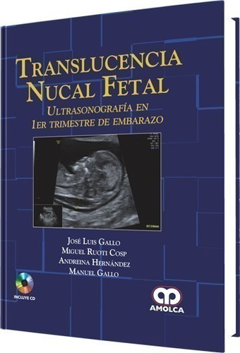 Translucencia Nucal Fetal. Ultrasonog. 1º Trim. Del Embarazo