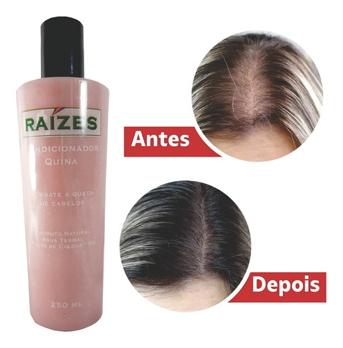 Shampoo + Condicionador De Quina Combate A Queda De Cabelo