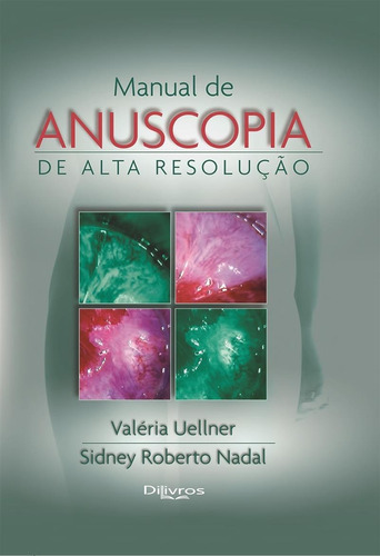 Manual De Anuscopia De Alta Resolucao, De Valeria Uellner. Editora Dilivros, Capa Dura Em Português, 2021