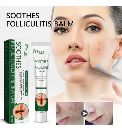 2×crema Hidratante Hidratante Para Eliminar La Foliculitis