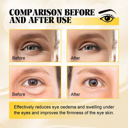 Mascarilla Reductora Mascarilla De Ojos Hidratada E Hidratan