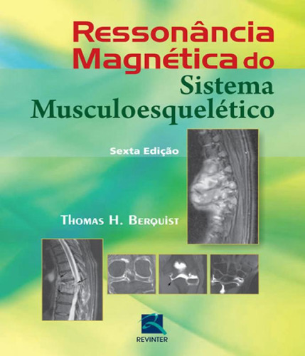 Livro Ressonância Magnética Do Sistema Musculoesquéletico