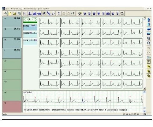 Holter Arritmia Cardíaca Profesional 3 Canales Contec