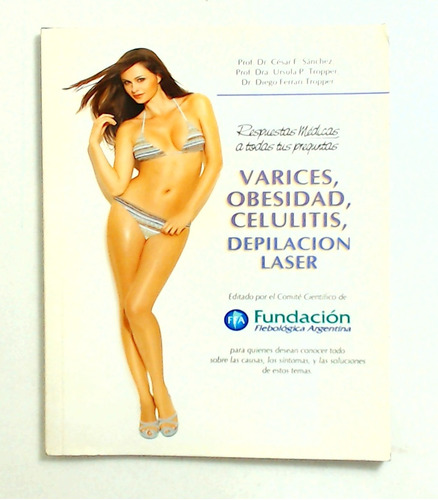 Varices, Obesidad, Celulitis, Depilacion Laser - Sanchez, Tr