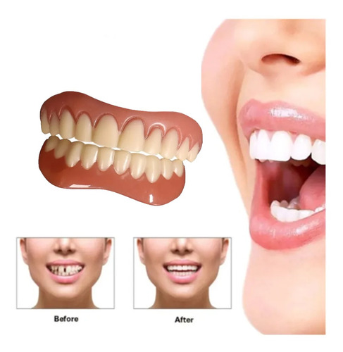 Perfecto Instant Smile Comfort Fit Flex Dientes Superiores W