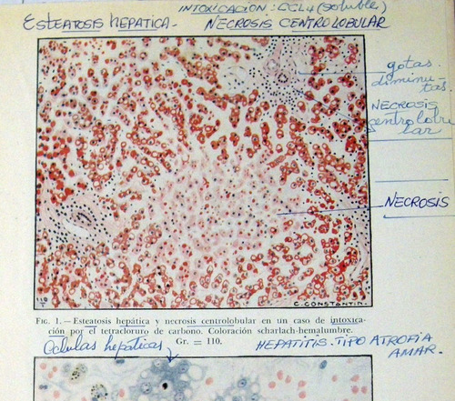 Bablet La Fiebre Amarilla Diagnostico 1948 Con Defectos