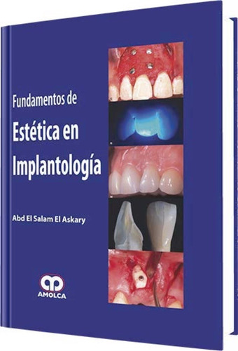 Fundamentos De Estética En Implantología