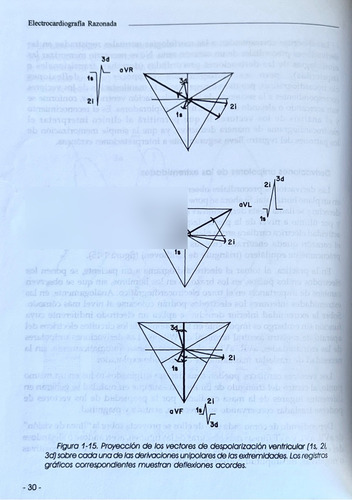 Electrocardiografía Razonada - Dr. Giovan Pasquali